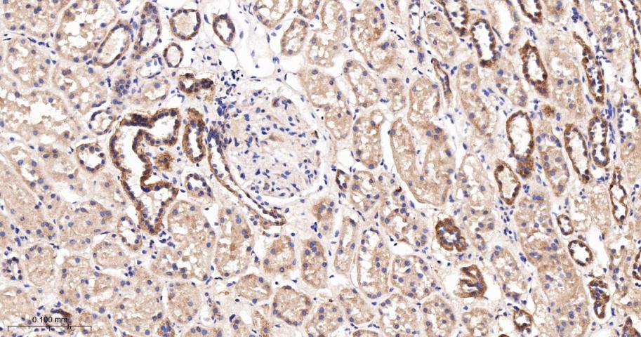 谷草转氨酶2重组兔单抗