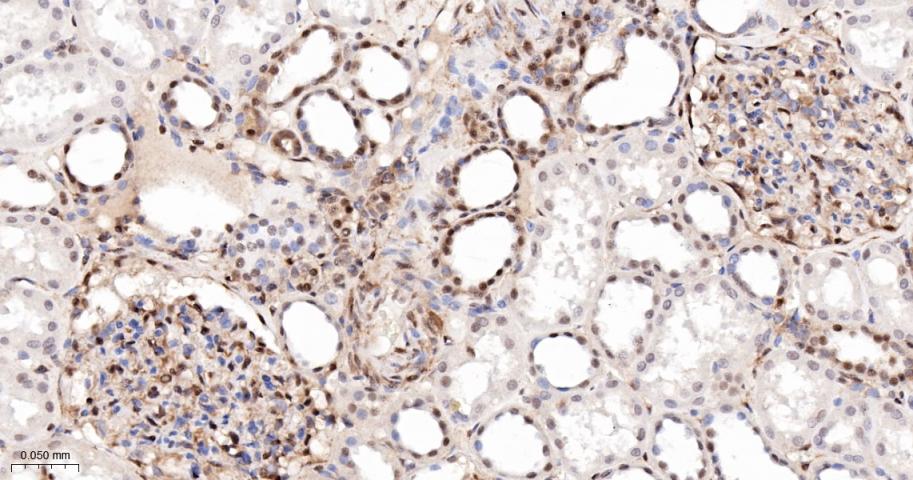 磷酸化S6核糖体蛋白重组兔单抗