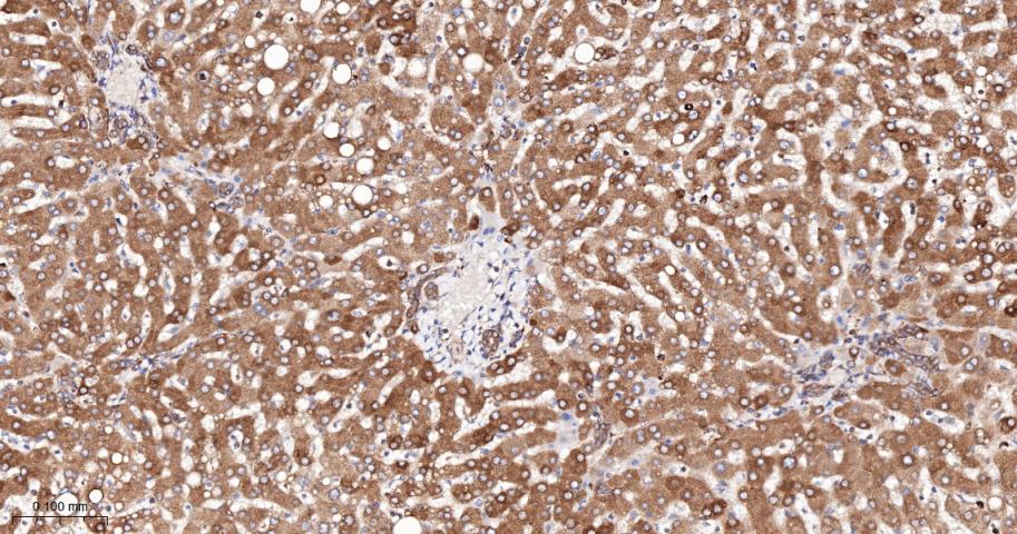 核酸酶敏感元件结合蛋白1重组兔单抗