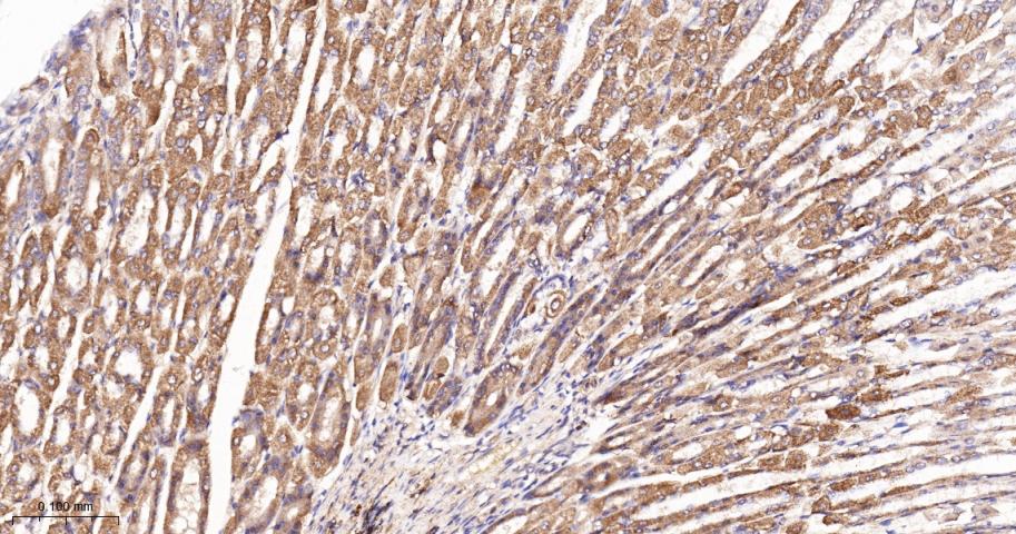 谷草转氨酶2重组兔单抗
