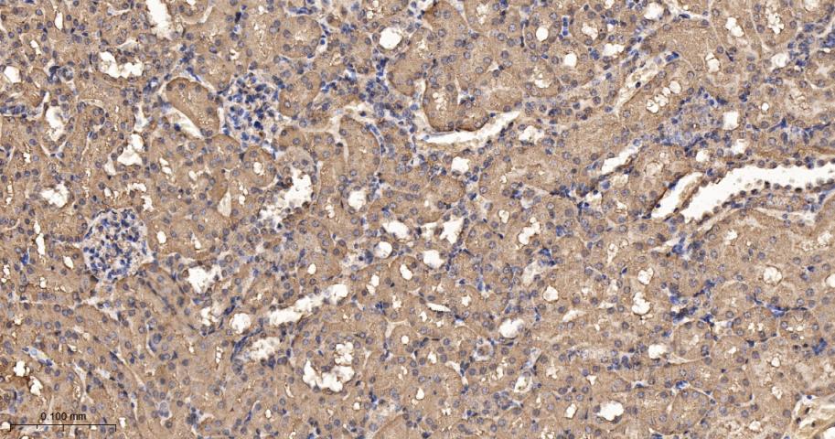 原癌基因Ras重组兔单抗