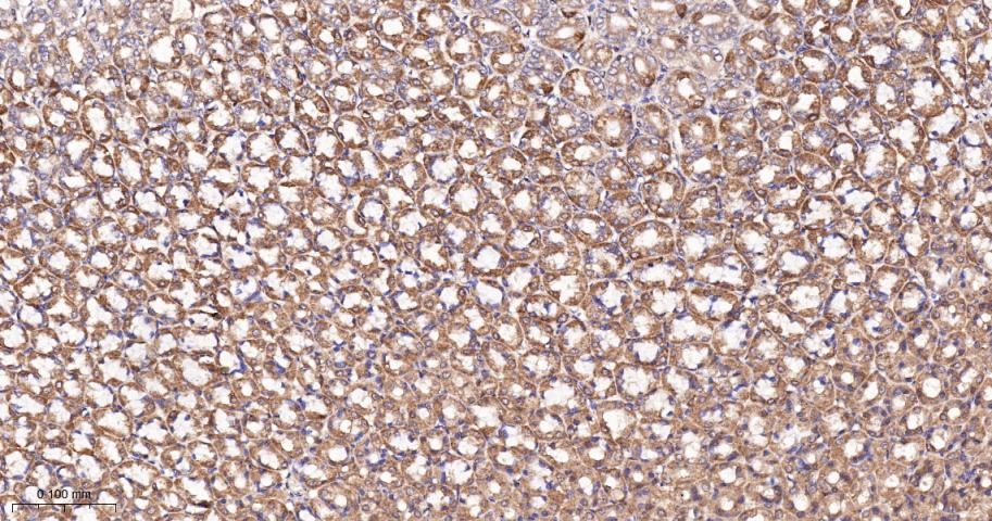 谷草转氨酶2重组兔单抗