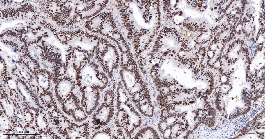 细胞周期检测点激酶2重组兔单抗