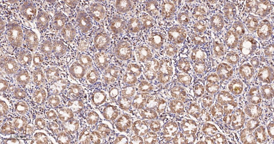 谷草转氨酶2重组兔单抗