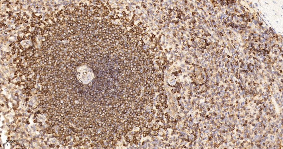 跨膜接头蛋白PAG重组兔单抗-bsm-62406R