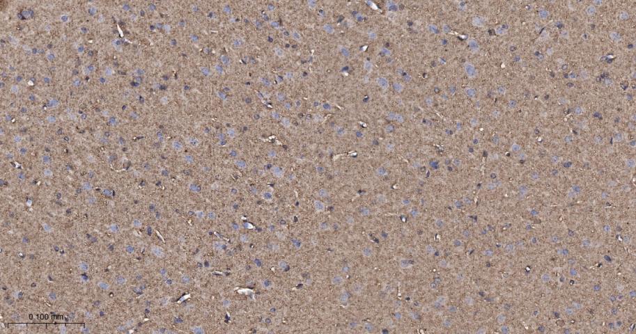 原癌基因Ras重组兔单抗