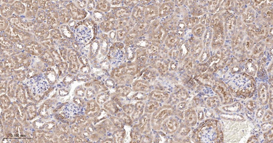 核酸酶敏感元件结合蛋白1重组兔单抗