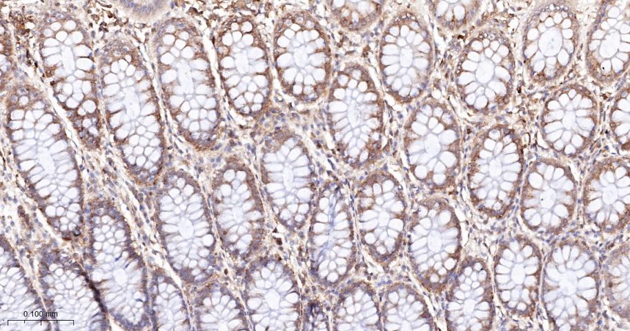 磷酸化S6核糖体蛋白重组兔单抗