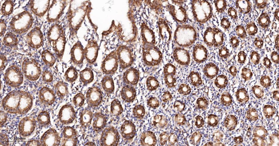 核酸酶敏感元件结合蛋白1重组兔单抗