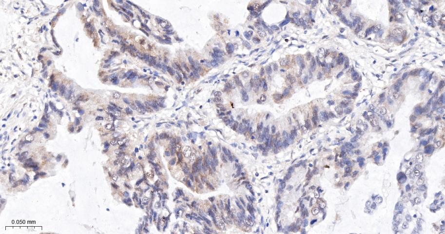 磷酸化S6核糖体蛋白重组兔单抗