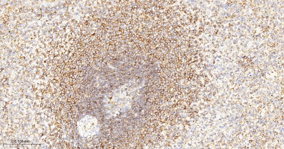 磷酸化S6核糖体蛋白重组兔单抗