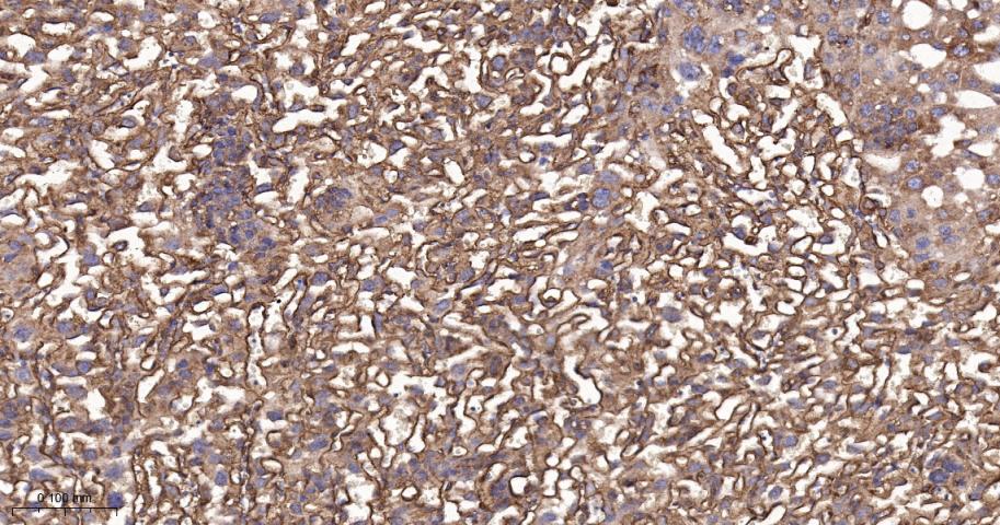 核酸酶敏感元件结合蛋白1重组兔单抗