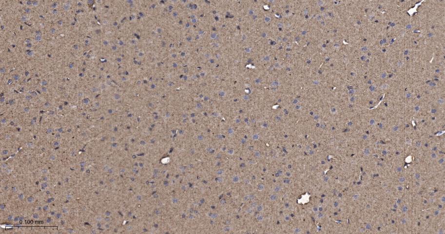 原癌基因Ras重组兔单抗