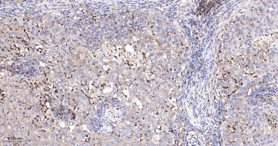 磷酸化S6核糖体蛋白重组兔单抗