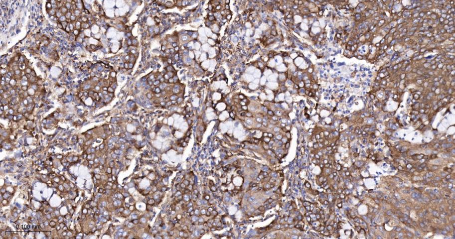 核酸酶敏感元件结合蛋白1重组兔单抗