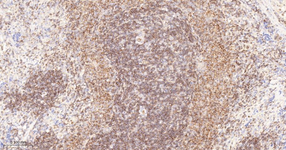 跨膜接头蛋白PAG重组兔单抗-bsm-62406R