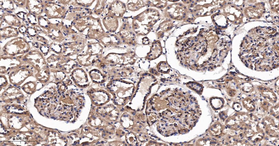 原癌基因Ras重组兔单抗