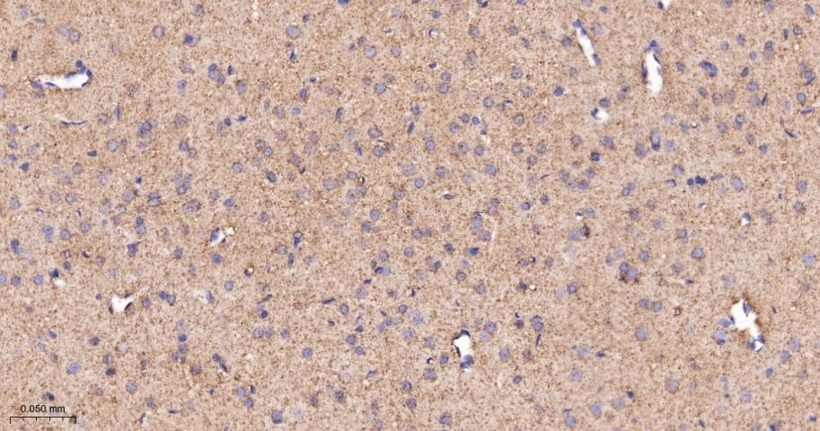 谷草转氨酶2重组兔单抗