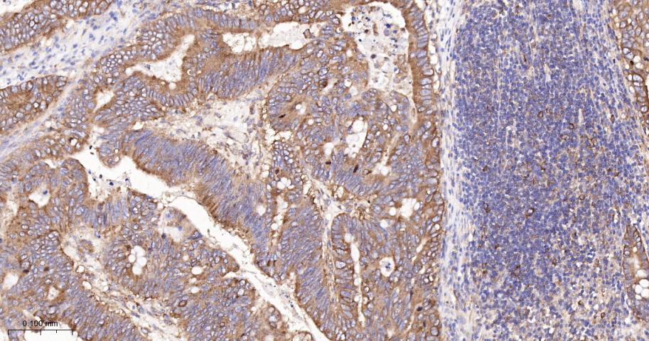 核酸酶敏感元件结合蛋白1重组兔单抗