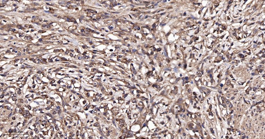 磷酯酶Cγ2重组兔单抗
