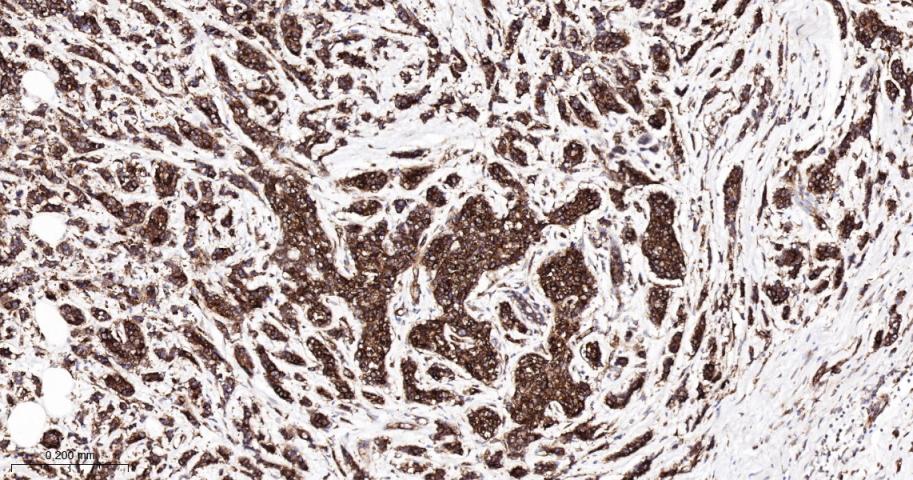 核酸酶敏感元件结合蛋白1重组兔单抗