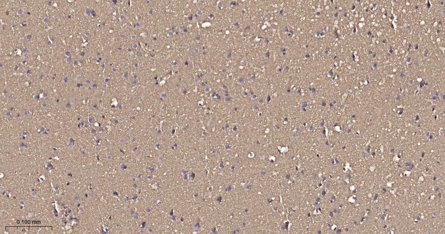 原癌基因Ras重组兔单抗