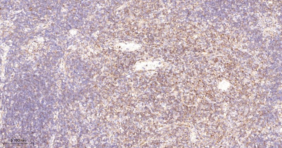 跨膜接头蛋白PAG重组兔单抗-bsm-62406R