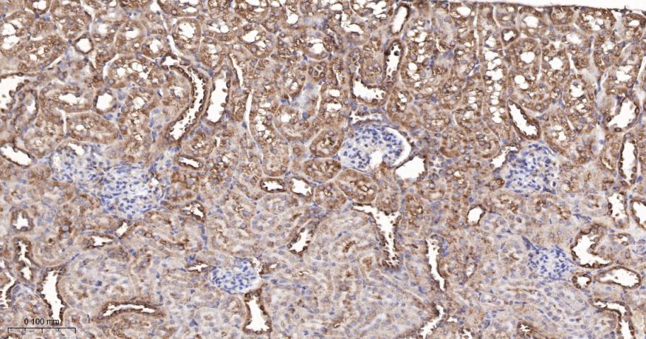 核酸酶敏感元件结合蛋白1重组兔单抗