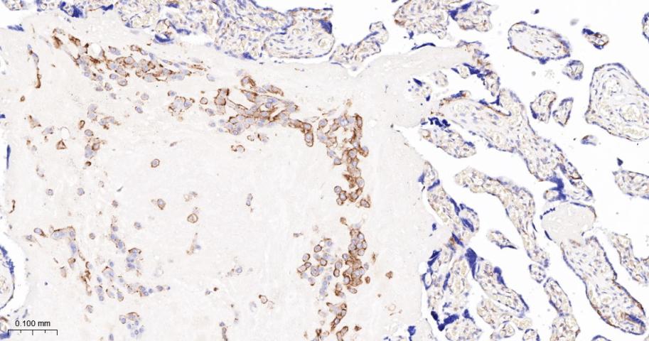 核酸酶敏感元件结合蛋白1重组兔单抗