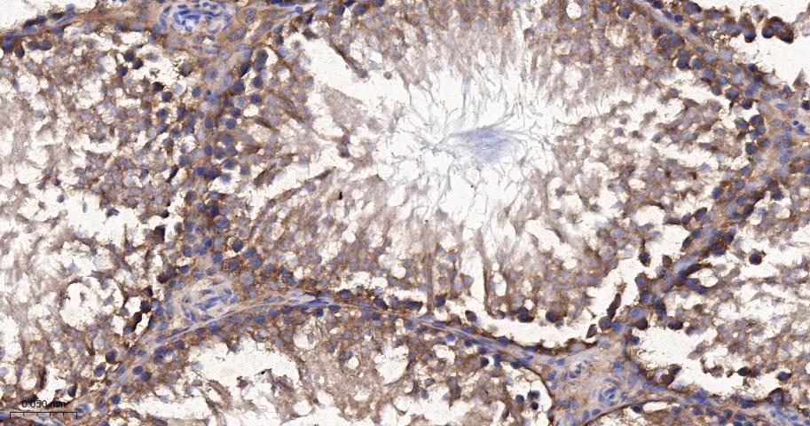 p53正向细胞凋亡调控因子重组兔单抗