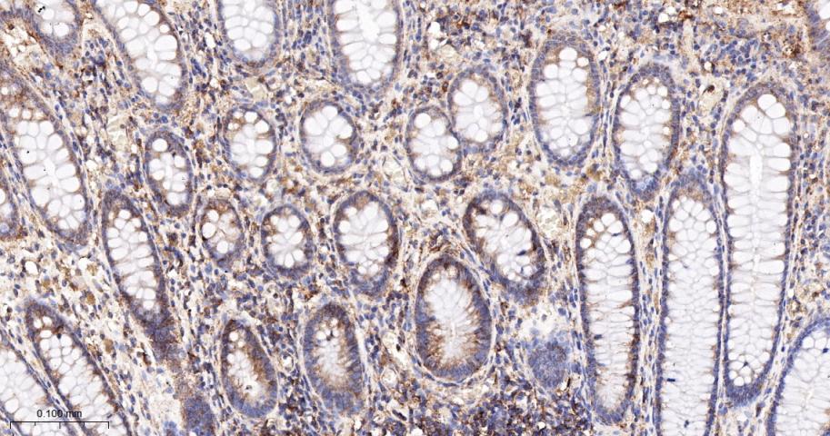 核酸酶敏感元件结合蛋白1重组兔单抗