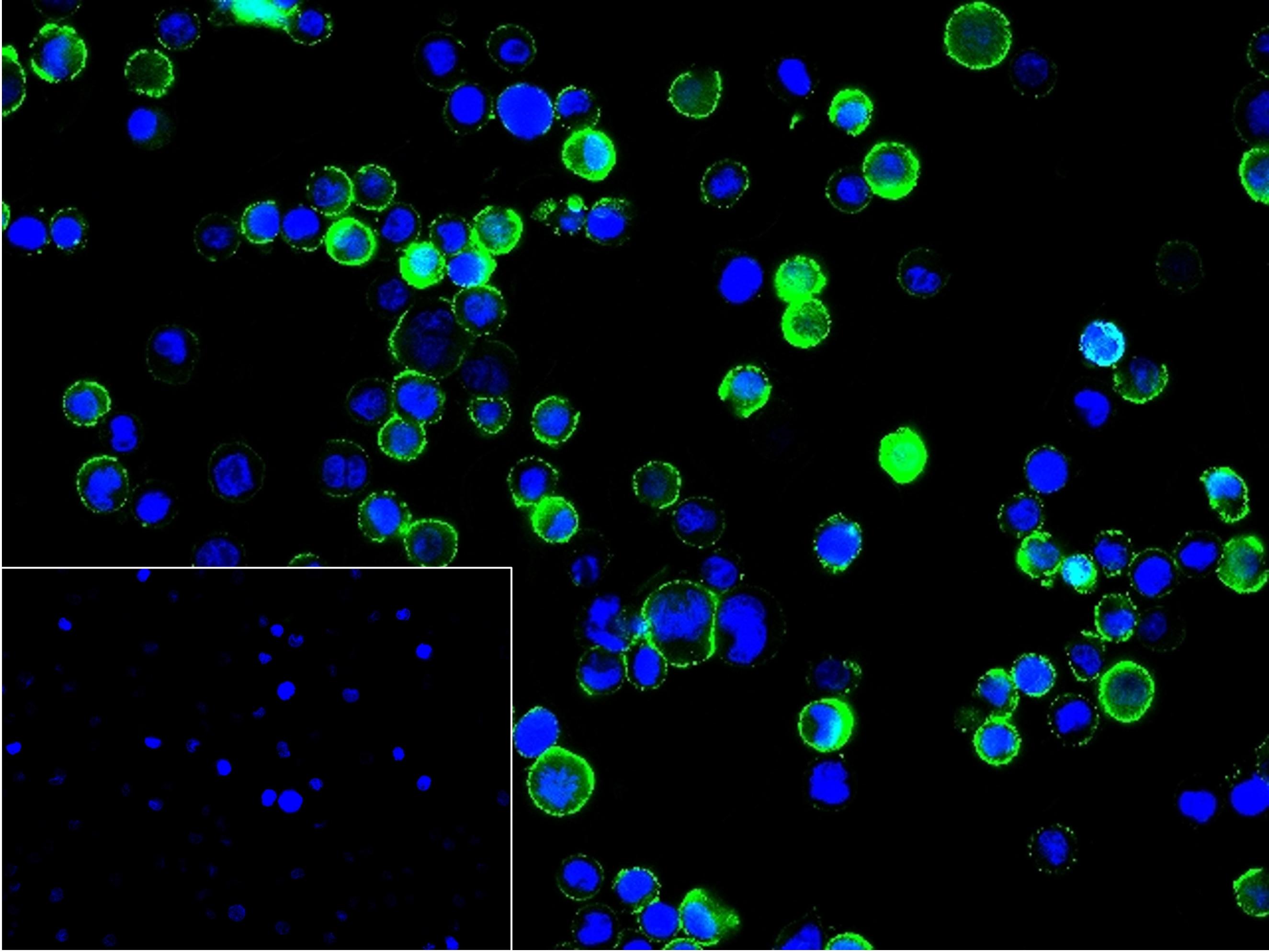 白细胞F肌动蛋白结合蛋白重组兔单抗