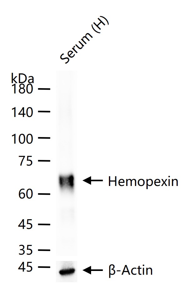 糖蛋白β-1B重组兔单抗