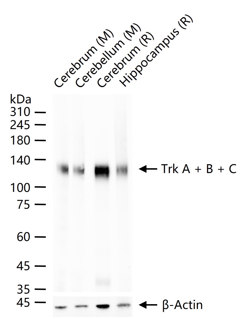 Trk-A & Trk-B & Trk-C Recombinant Rabbit mAb (一抗) - WB,IHC-P,IHC-F,IF,ICC/IF | Bioss