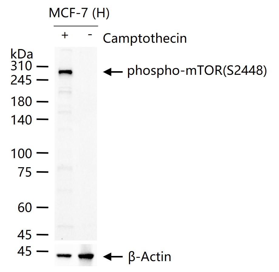磷酸化雷帕霉素靶蛋白重组兔单抗
