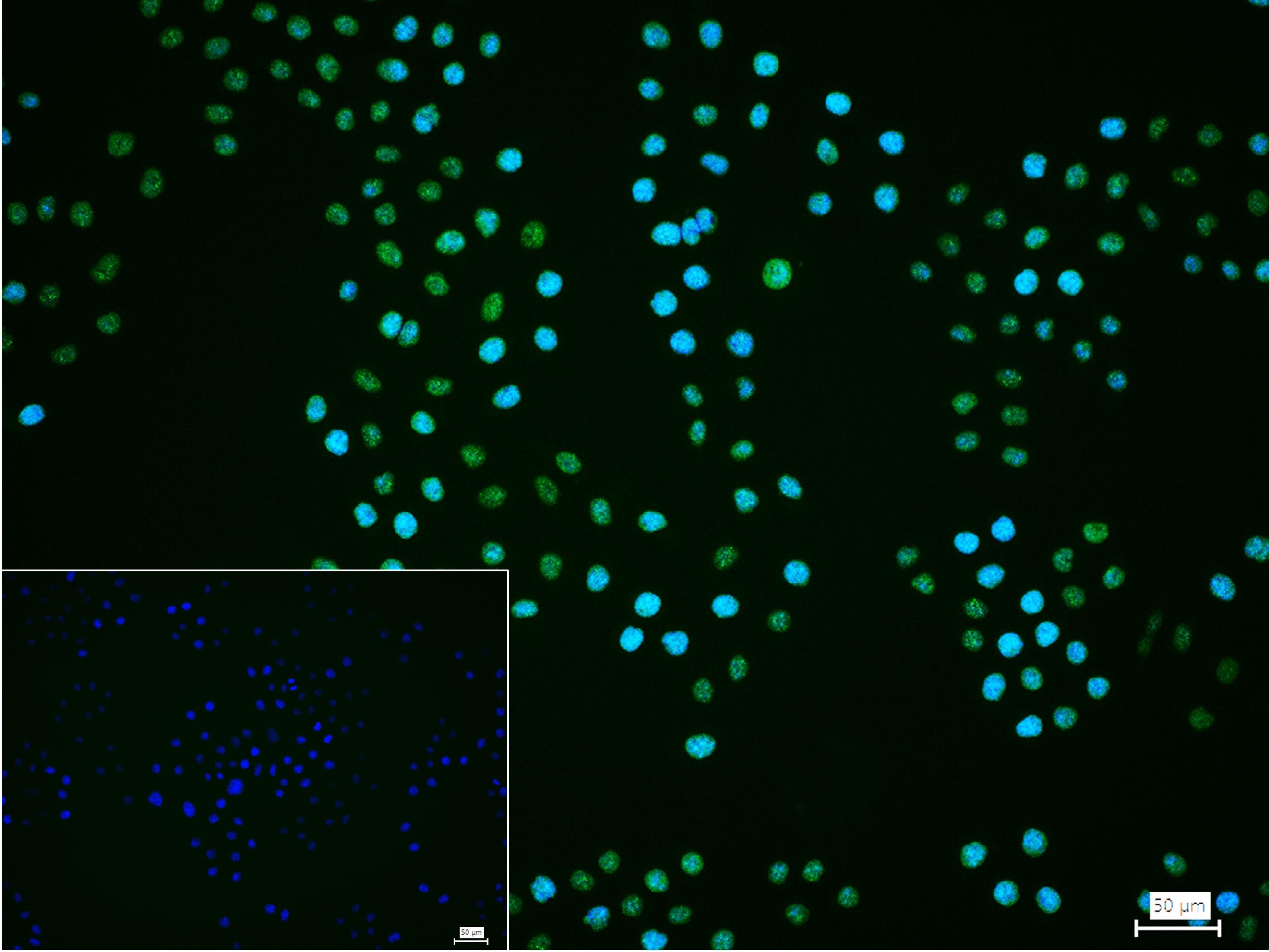 单甲基化组蛋白H3K18重组兔单抗