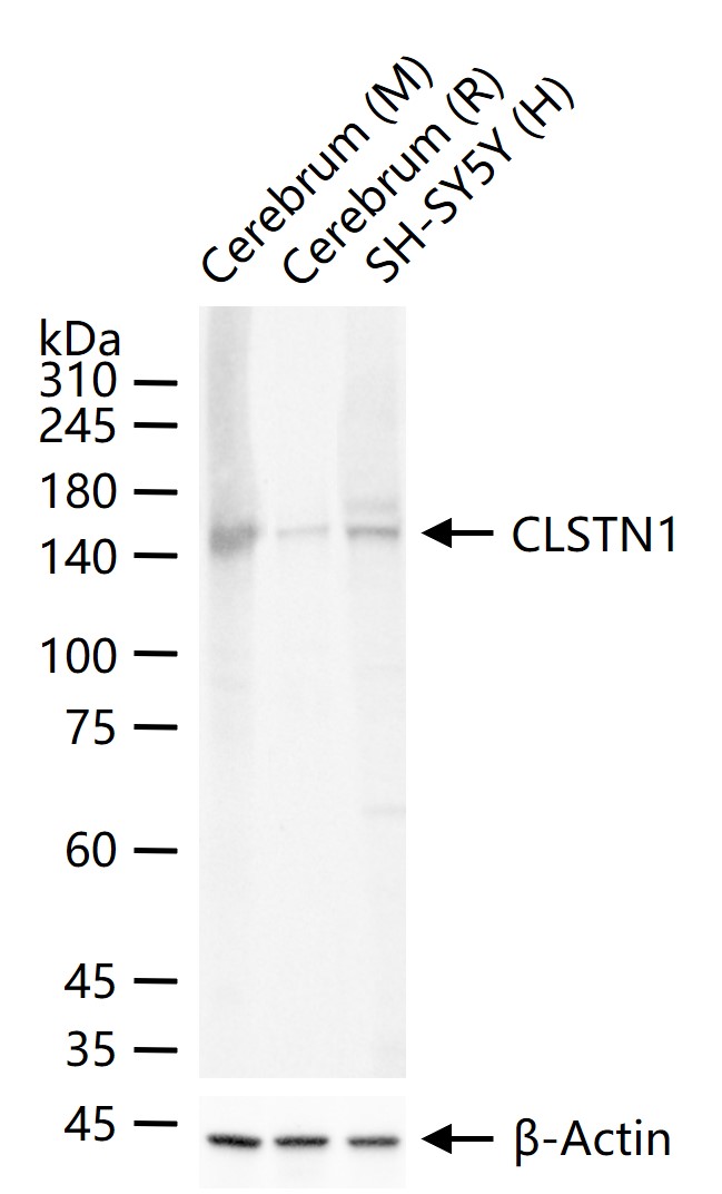 老年痴呆相关类钙粘蛋白CS1重组兔单抗