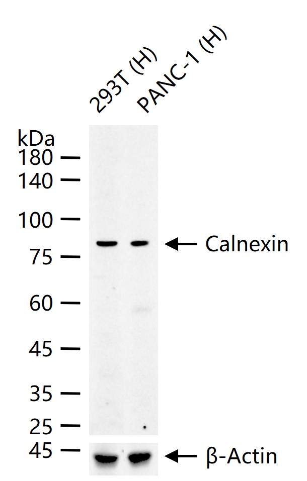 钙连蛋白重组兔单抗