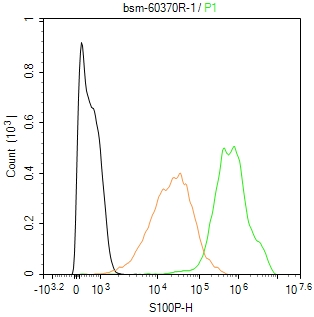 S100钙结合蛋白P重组兔单抗