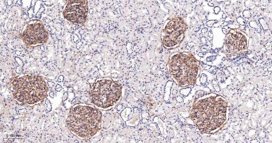 血小板源性生长因子受体B/PDGFRβ重组兔单抗