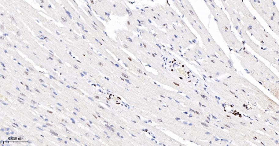 磷酸化信号转导和转录激活因子3重组兔单抗