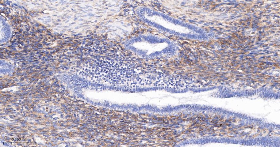 血小板源性生长因子受体B/PDGFRβ重组兔单抗