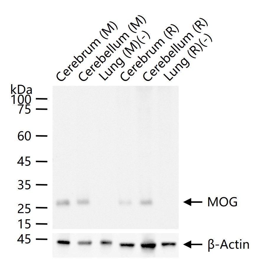 髓鞘少树突胶质细胞糖蛋白重组兔单抗