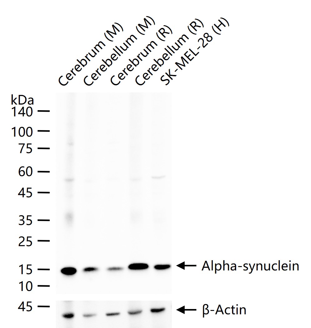 Alpha-Synuclein Rabbit pAb (一抗) - WB | Bioss