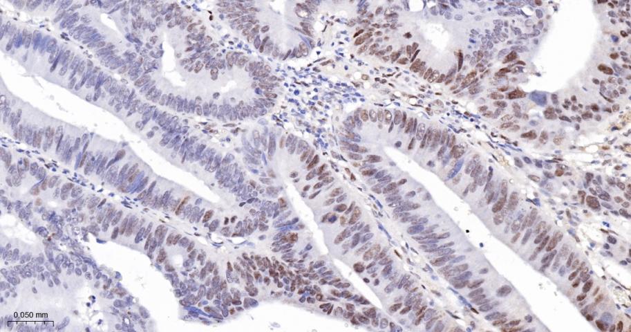 磷酸化信号转导和转录激活因子3重组兔单抗