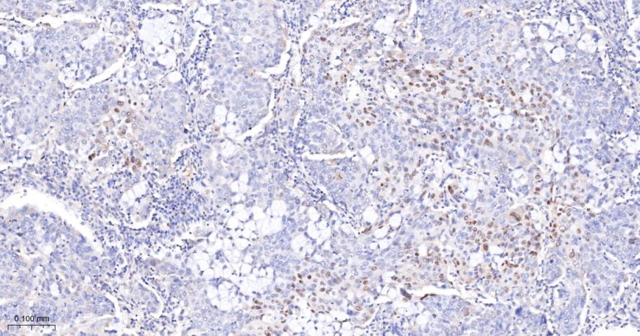 磷酸化信号转导和转录激活因子3重组兔单抗