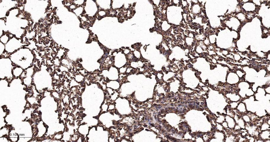 葡萄糖转运蛋白1重组兔单抗