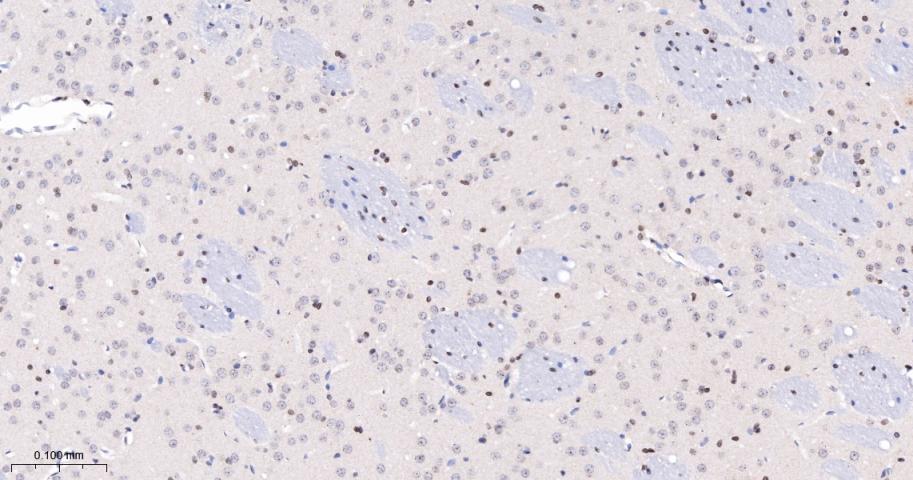 磷酸化信号转导和转录激活因子5a重组兔单抗