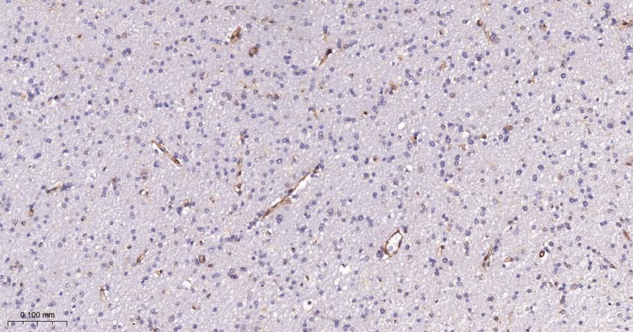 血小板源性生长因子受体B/PDGFRβ重组兔单抗