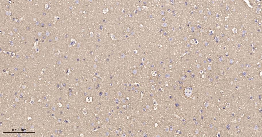 神经生长相关蛋白43重组兔单克隆抗体